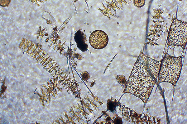 Foto på plankton genom ett microskop.